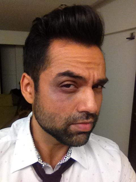Abhay Deol Injured